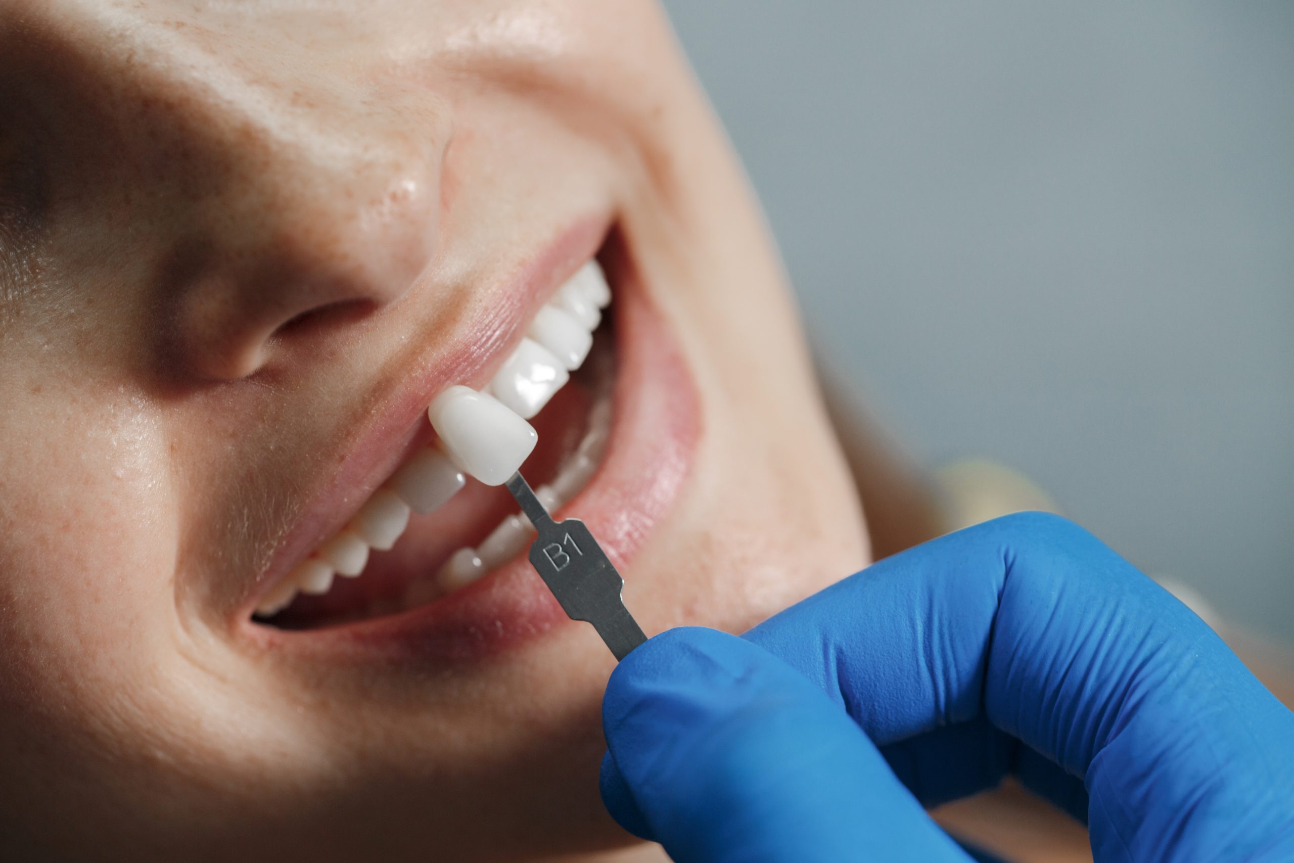 tooth replacement treatment